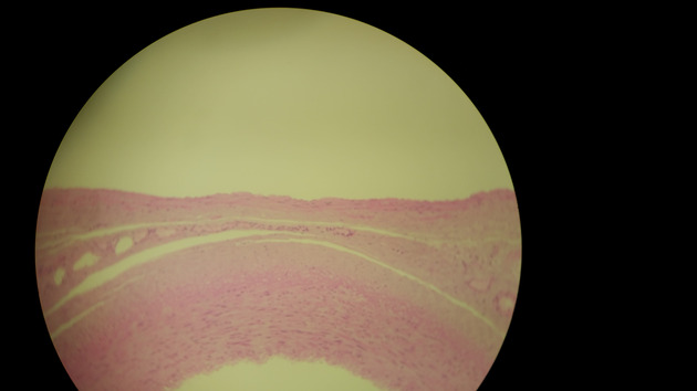 Artery and Vein Slides - Artery and Vein 002 100X